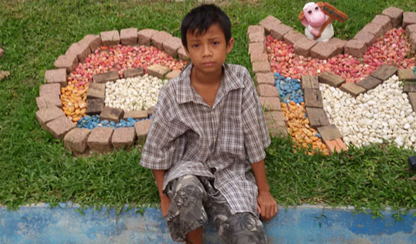 Photo of Myo Chit post-operation