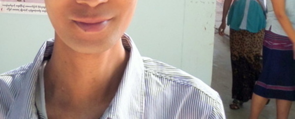 Photo of Aung Myo post-operation