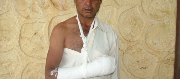 Photo of Prem post-operation