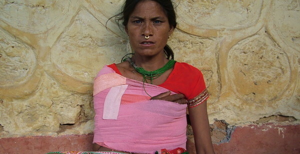 Paru Devi from Nepal raised $205 to heal her shoulder. | Watsi