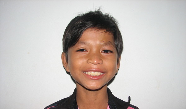 Photo of Visal post-operation