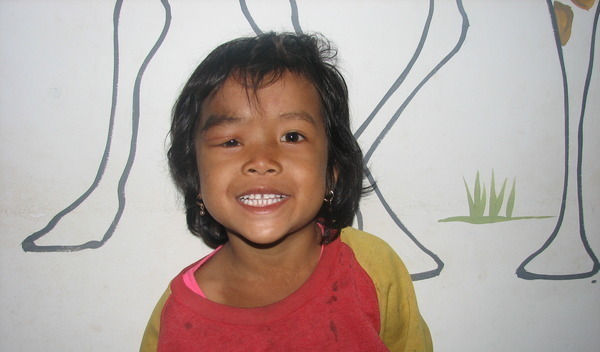 Photo of Meyly post-operation
