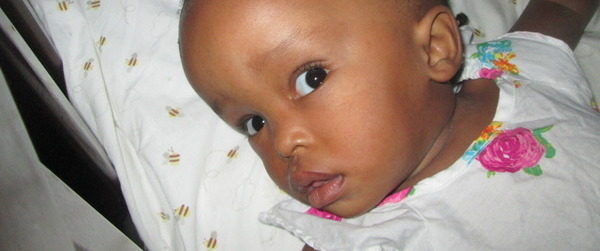 Photo of Medhar post-operation