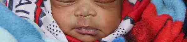 Nelly from Kenya raised $805 for life-saving spinal surgery. | Watsi