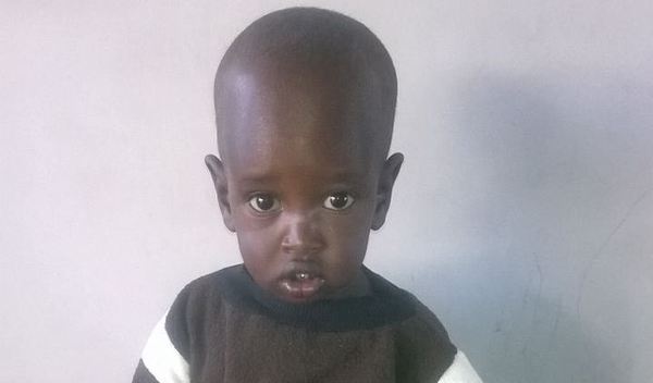 Photo of Mathayo post-operation