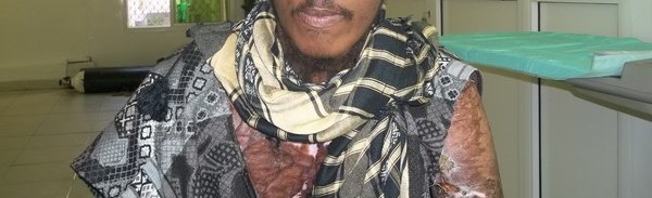 Photo of Aydarus post-operation