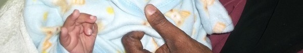 Photo of Amina post-operation