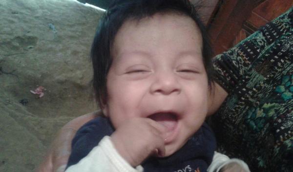 Photo of Fredy post-operation