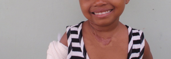 Photo of Susan Eliniachie post-operation