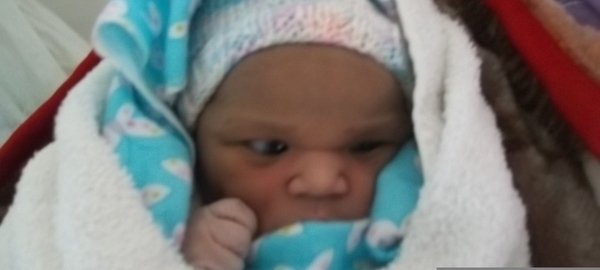 Photo of Hinda post-operation