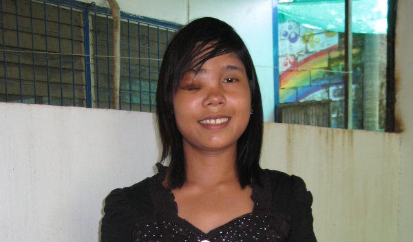Shwe Shwe from Burma raised $1,500 to get healthy. | Watsi