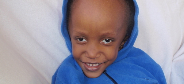 Photo of Yese post-operation