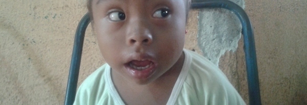 Photo of Ana post-operation