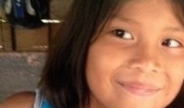 Photo of Roxana post-operation