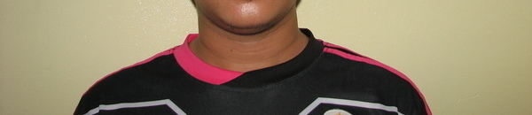 Photo of Chanty post-operation