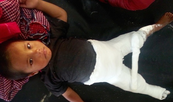 Photo of Shankar post-operation