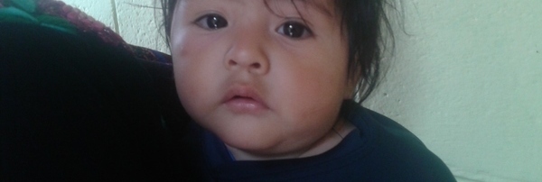 Photo of Andres post-operation