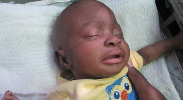 Photo of Jennie post-operation