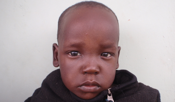 Photo of Lemekwetu post-operation