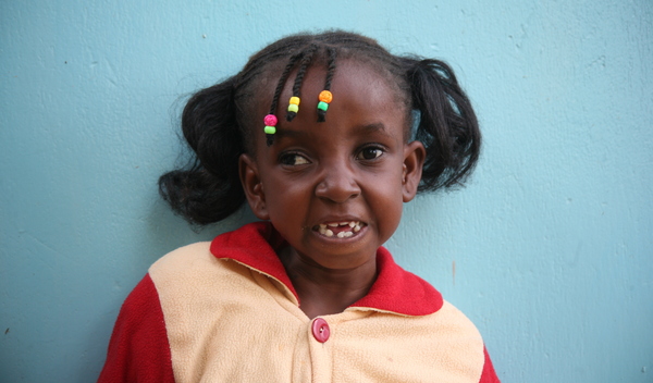 Photo of Mwanakombo post-operation