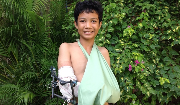 Photo of Phanna post-operation