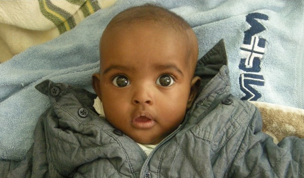 Photo of Fadix post-operation