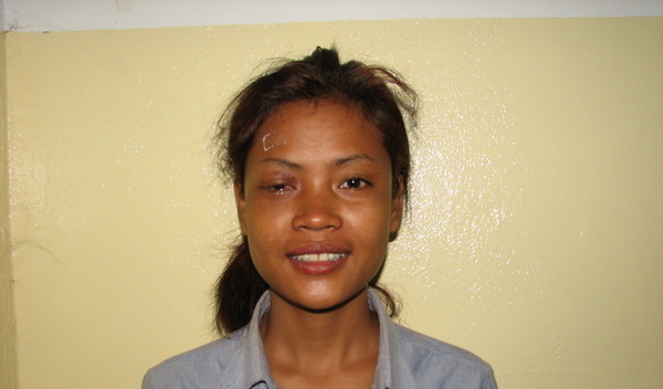 Photo of Chan post-operation