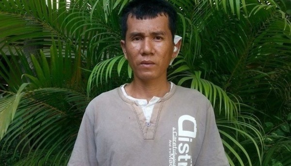 Photo of Makara post-operation