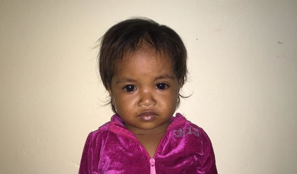 Photo of Vantha post-operation