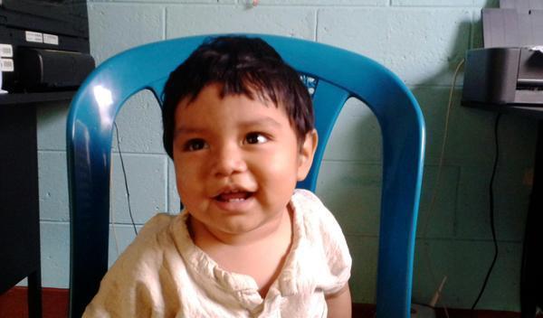 Photo of Jeferson post-operation