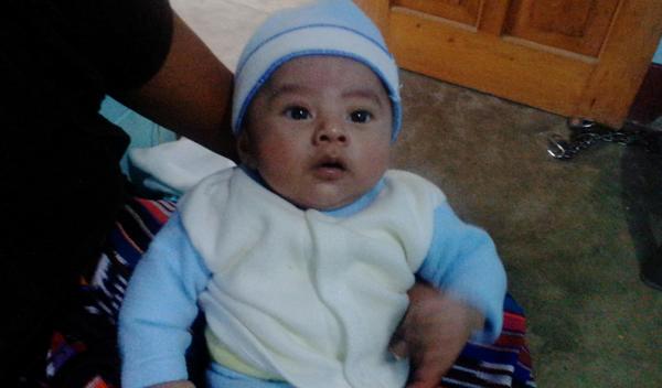 Photo of Eduardo post-operation